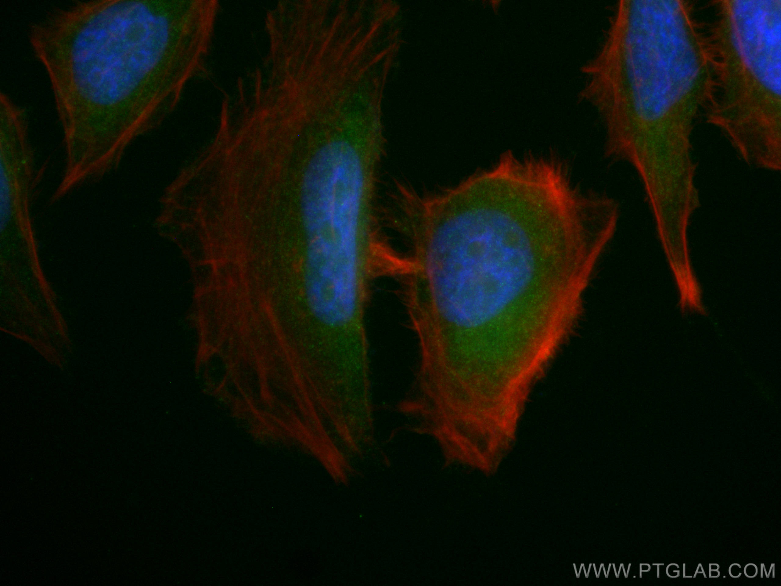 IF Staining of HeLa using 14429-1-AP