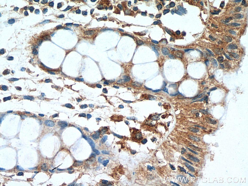 IHC staining of human colon using 14429-1-AP