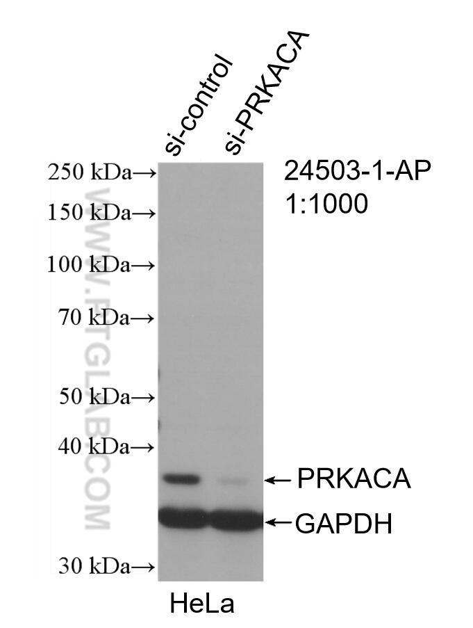 WB analysis of HeLa using 24503-1-AP