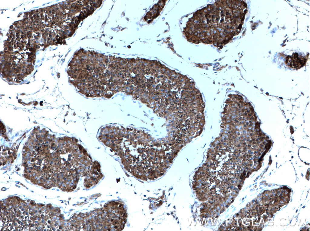 IHC staining of human testis using 27398-1-AP