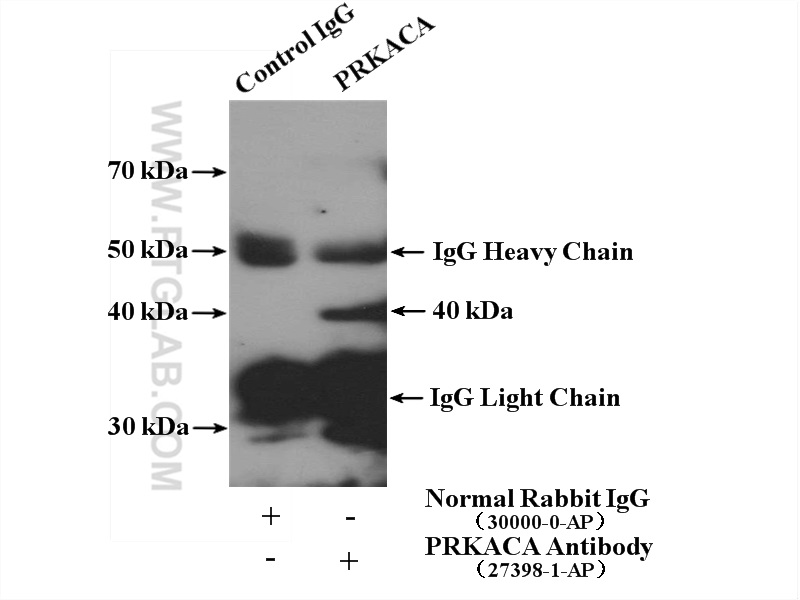 IP experiment of HeLa using 27398-1-AP