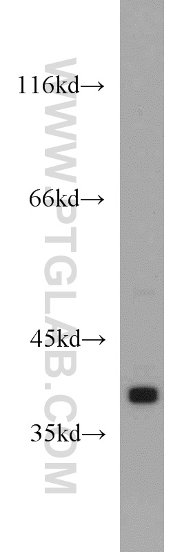 WB analysis of human testis using 55388-1-AP