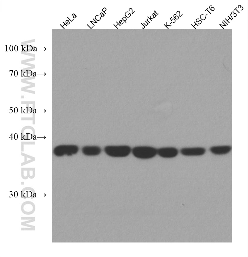 WB analysis using 67491-1-Ig