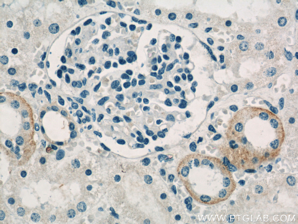 IHC staining of human kidney using 55382-1-AP