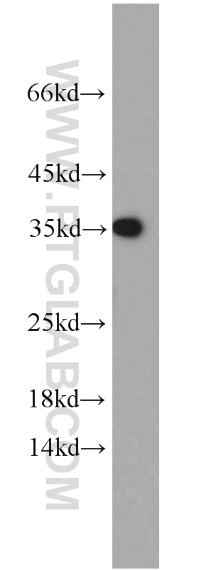 WB analysis of mouse brain using 55382-1-AP