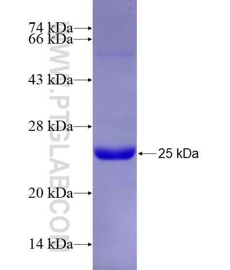 PRKAG1 fusion protein Ag28907 SDS-PAGE