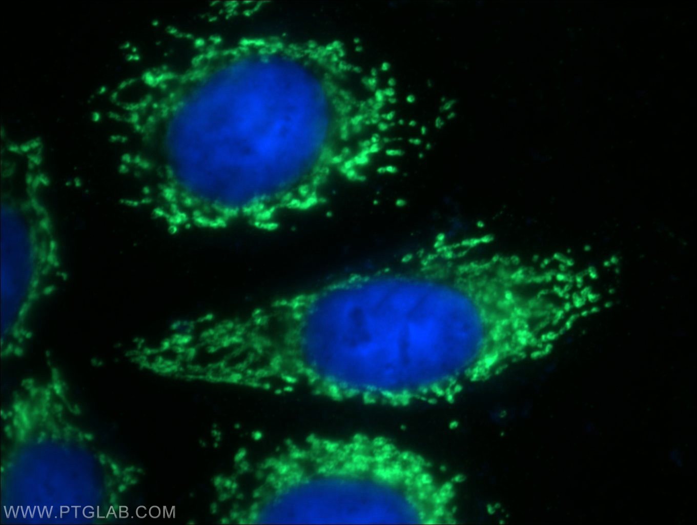 IF Staining of HeLa using 12568-1-AP