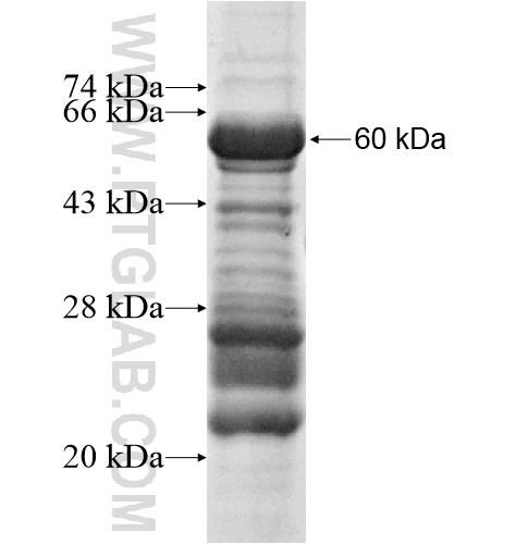 PRKAG3 fusion protein Ag15826 SDS-PAGE PRKAG3 fusion protein Ag15826 SDS-PAGE