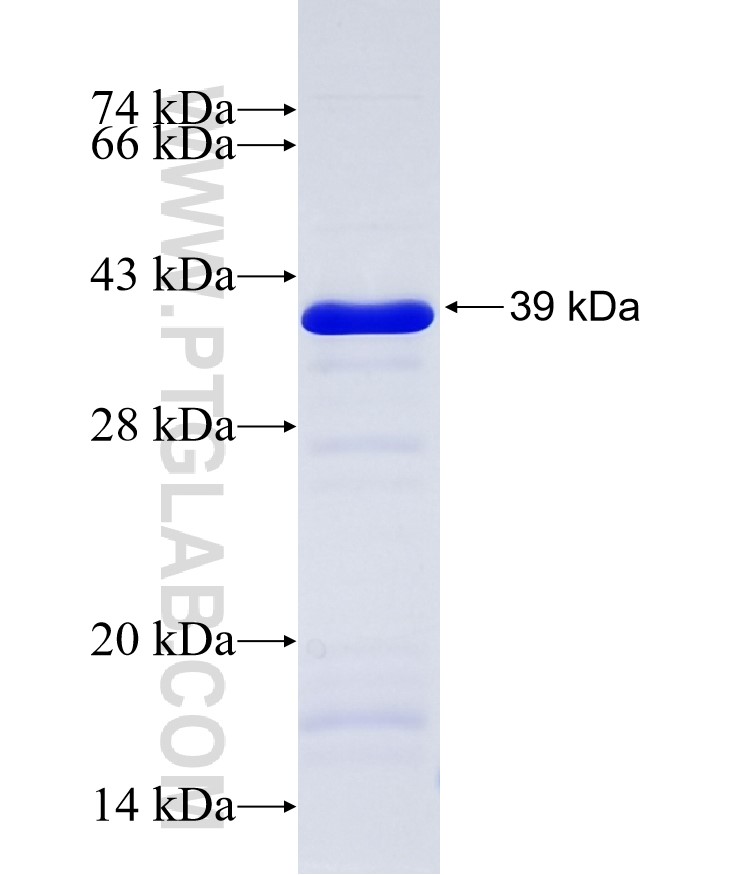 PRKAG3 fusion protein Ag17622 SDS-PAGE PRKAG3 fusion protein Ag17622 SDS-PAGE
