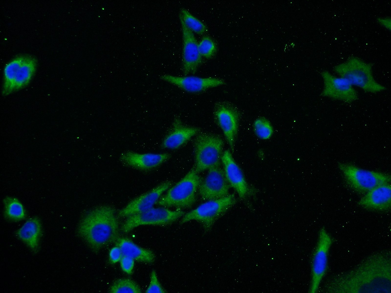 IF Staining of HeLa using 20358-1-AP