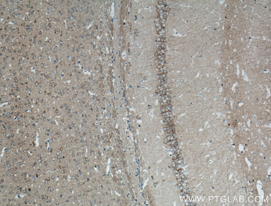 IHC staining of mouse brain using 20358-1-AP