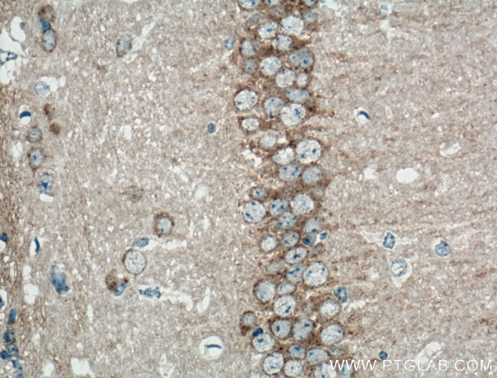 IHC staining of mouse brain using 20358-1-AP