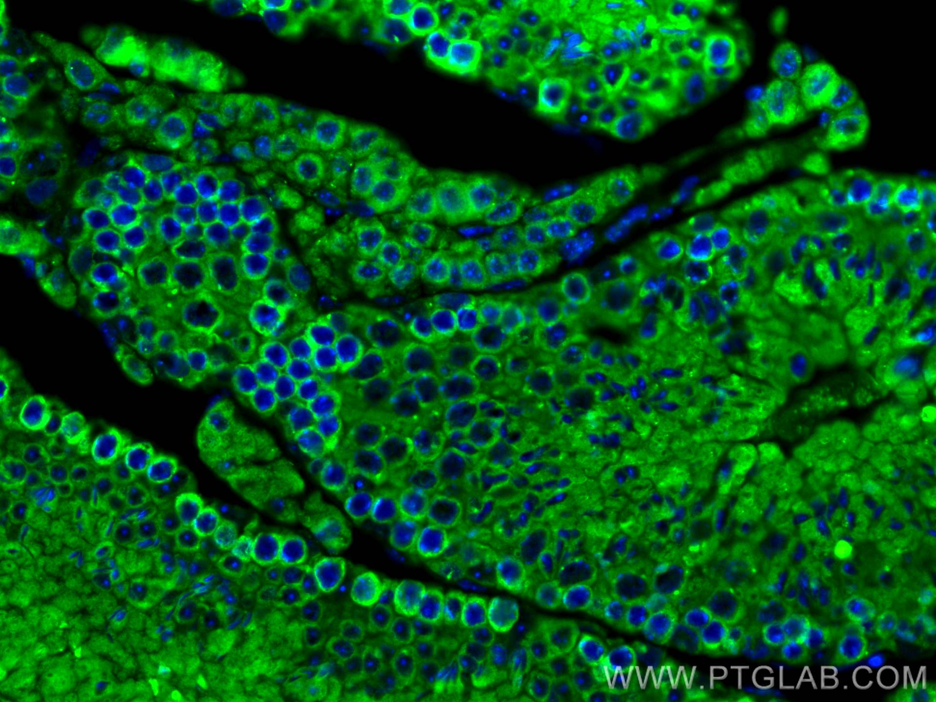 IF Staining of mouse testis using 10142-2-AP