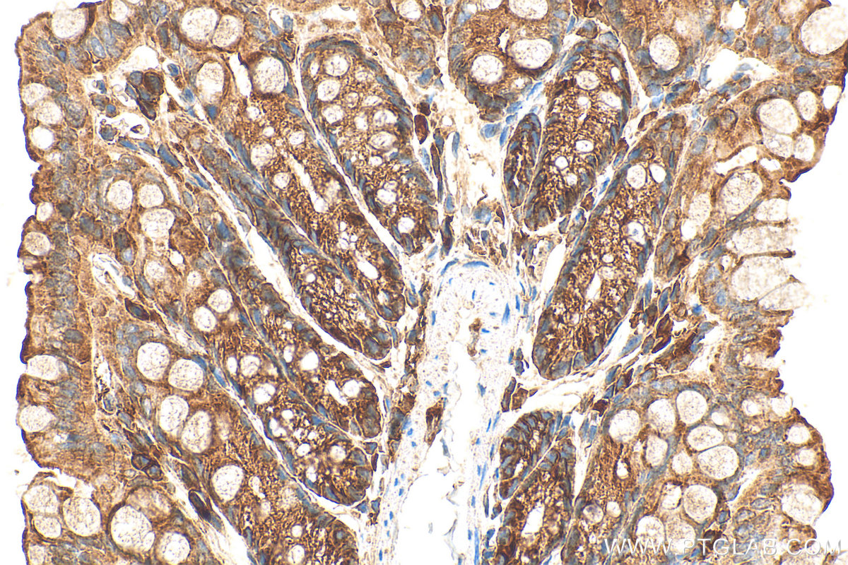 Immunohistochemical analysis of paraffin-embedded mouse colon tissue slide using 10142-2-AP (PRKAR2A antibody) at dilution of 1:200 (under 40x lens). Heat mediated antigen retrieval with Tris-EDTA buffer (pH 9.0). IHC staining of mouse colon using 10142-2-AP