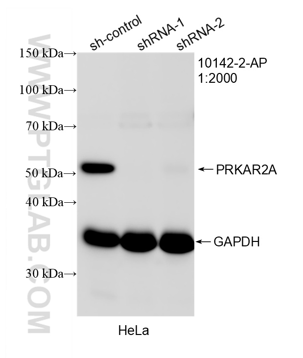 WB analysis of HeLa using 10142-2-AP