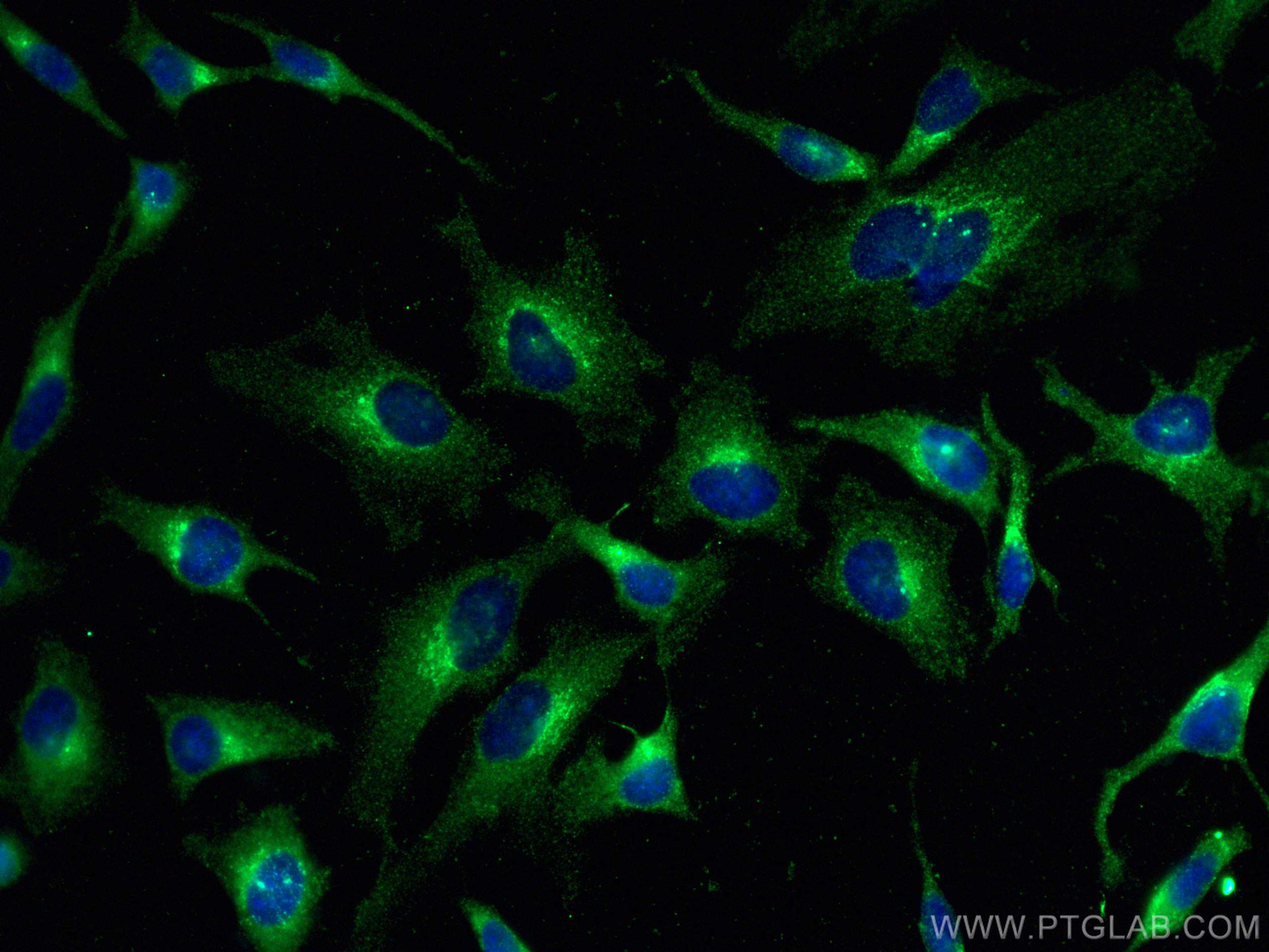 IF Staining of HeLa using 67751-1-Ig (same clone as 67751-1-PBS)