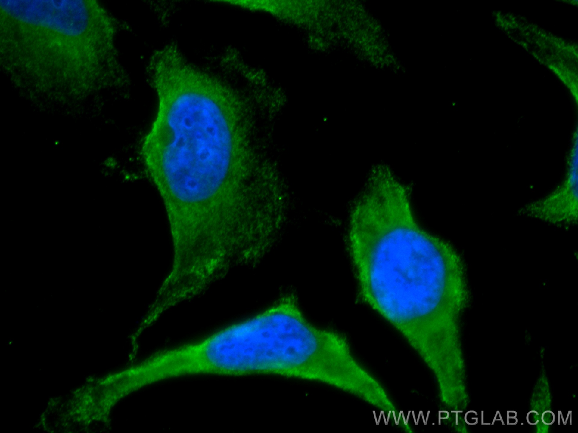 IF Staining of HeLa using CL488-67751