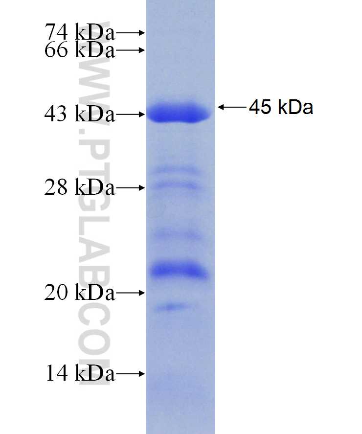 PRKAR2A fusion protein Ag29893 SDS-PAGE