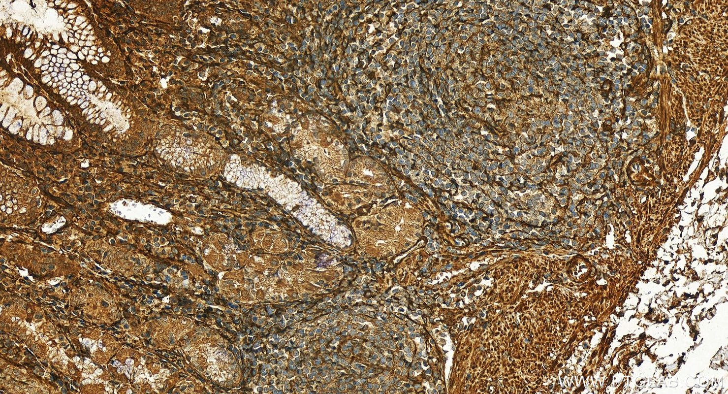 IHC staining of human stomach using 28351-1-AP