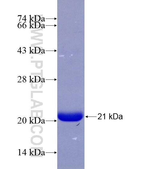 PRKAR2B fusion protein Ag28798 SDS-PAGE PRKAR2B fusion protein Ag28798 SDS-PAGE