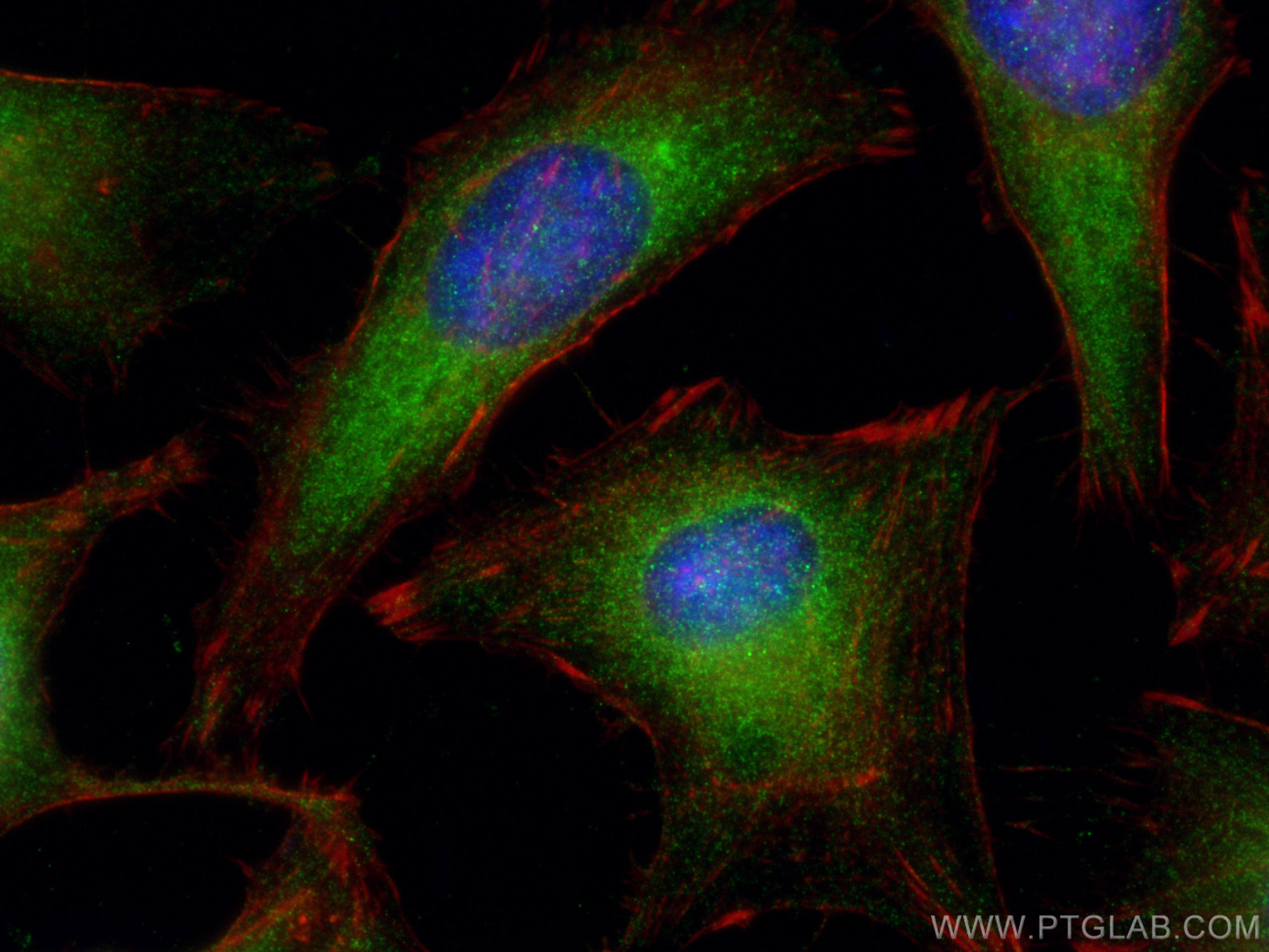 IF Staining of HeLa using 21991-1-AP