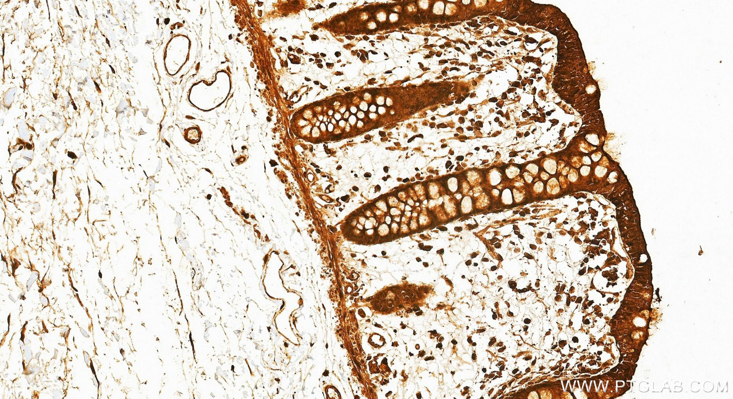 IHC staining of human colon using 12919-1-AP