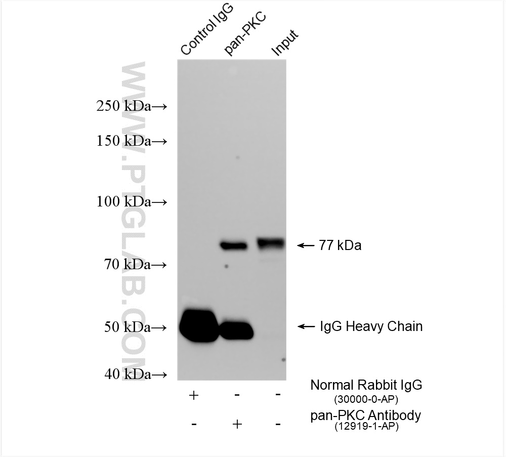 IP experiment of mouse brain using 12919-1-AP