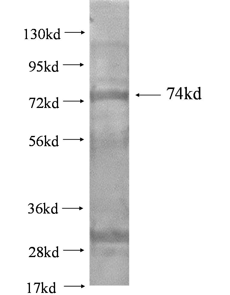 PRKCB fusion protein Ag0900 SDS-PAGE PRKCB fusion protein Ag0900 SDS-PAGE