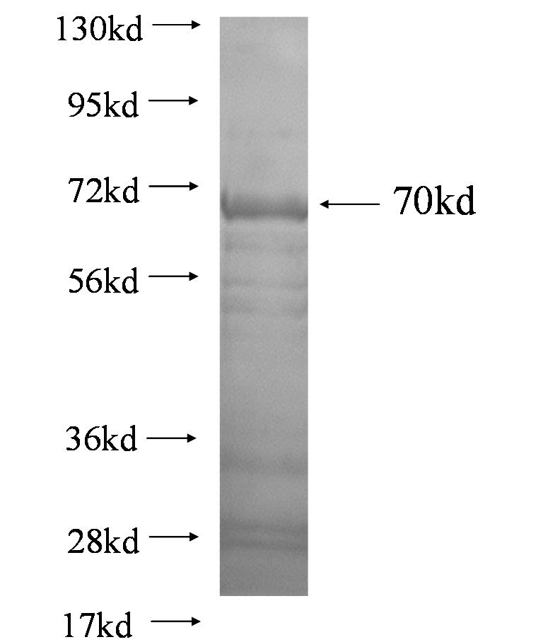 PRKCB fusion protein Ag0918 SDS-PAGE PRKCB fusion protein Ag0918 SDS-PAGE