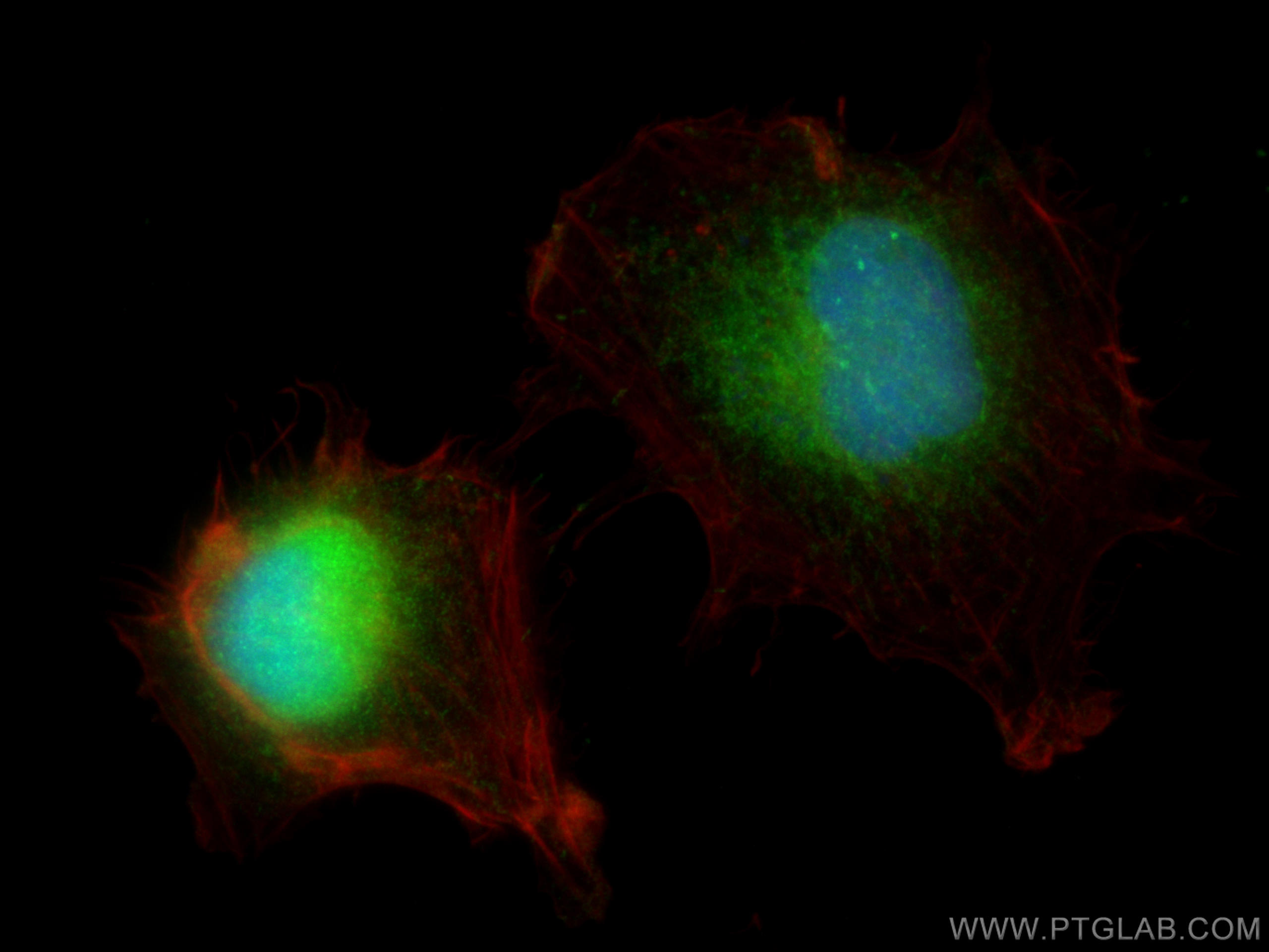 IF Staining of U-251 using 19132-1-AP