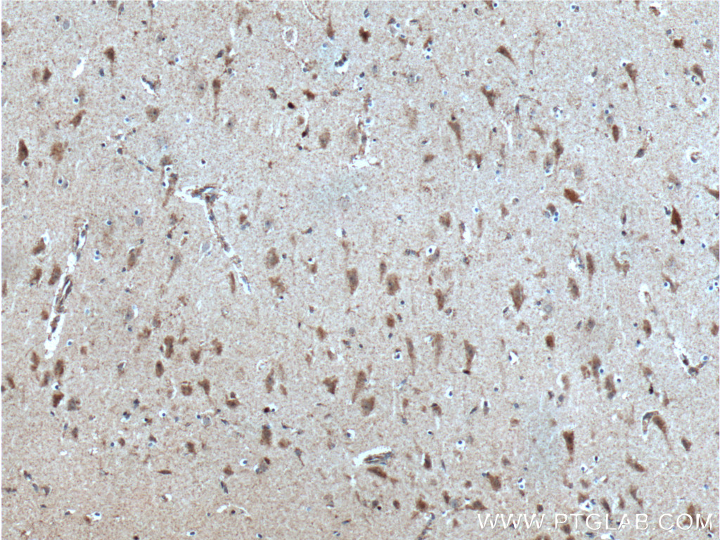 IHC staining of human brain using 19132-1-AP