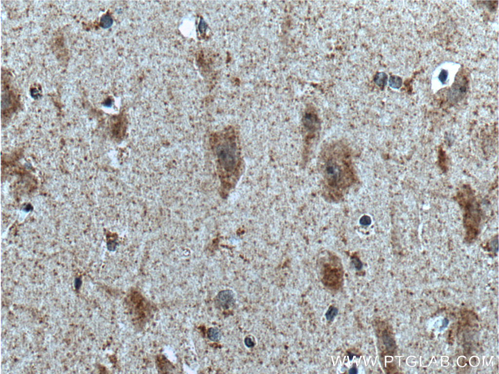 IHC staining of human brain using 19132-1-AP