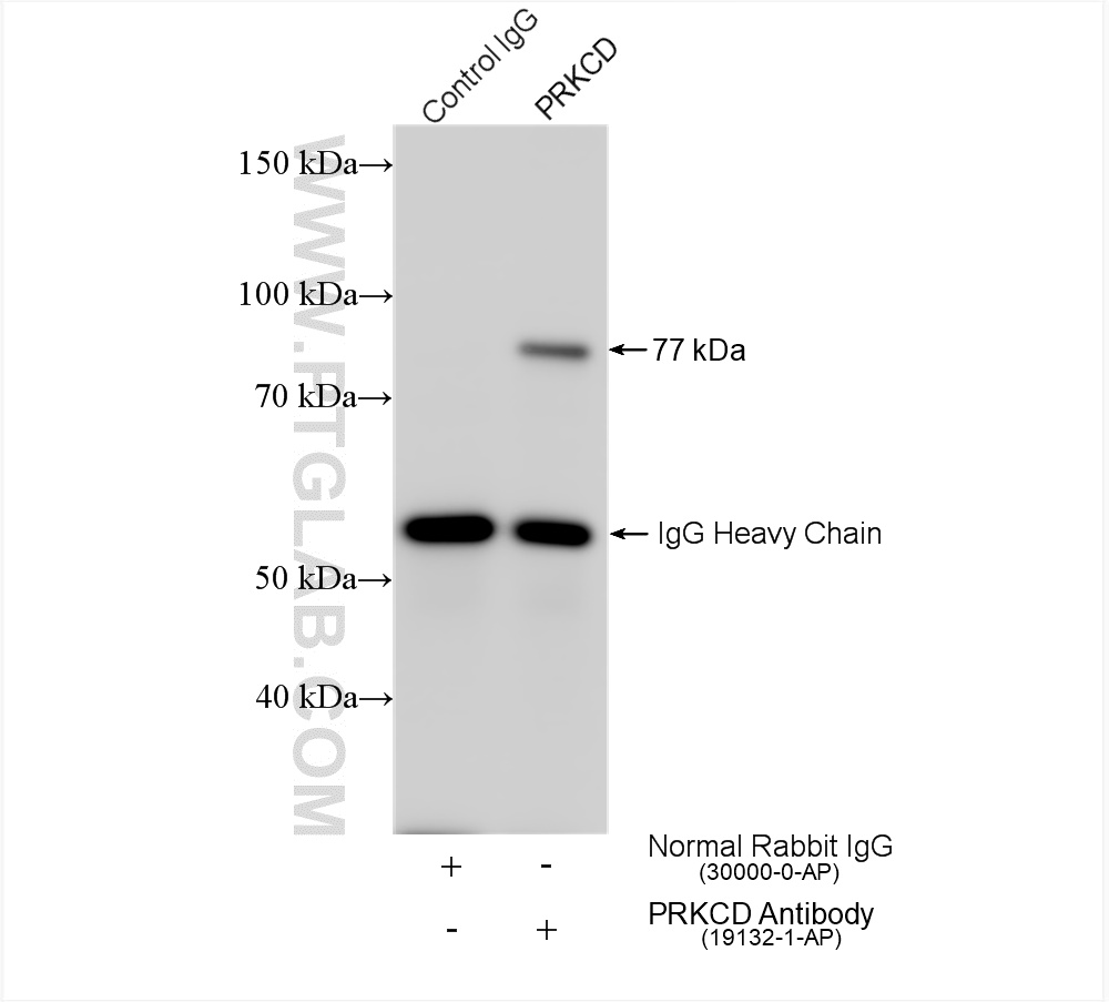 IP experiment of A431 using 19132-1-AP