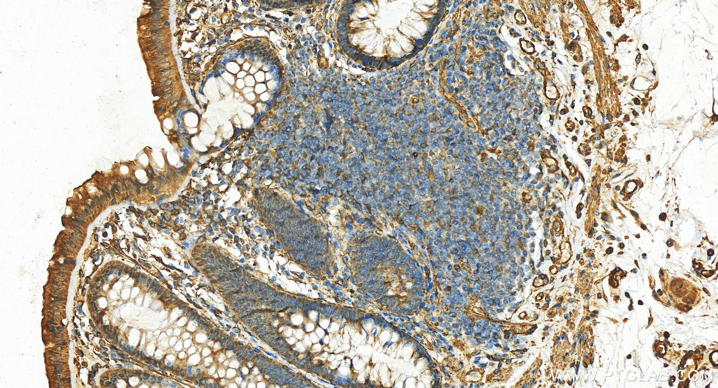 IHC staining of human normal colon using 16250-1-AP