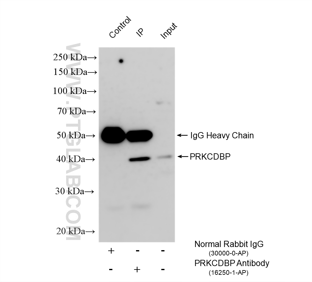 IP result of anti-PRKCDBP (IP:16250-1-AP, 4ug; Detection:16250-1-AP 1:1000) with A549 cells lysate 1120 ug. IP experiment of A549 using 16250-1-AP