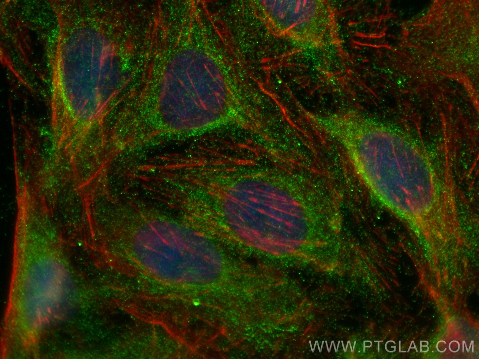 IF Staining of U2OS using 20877-1-AP