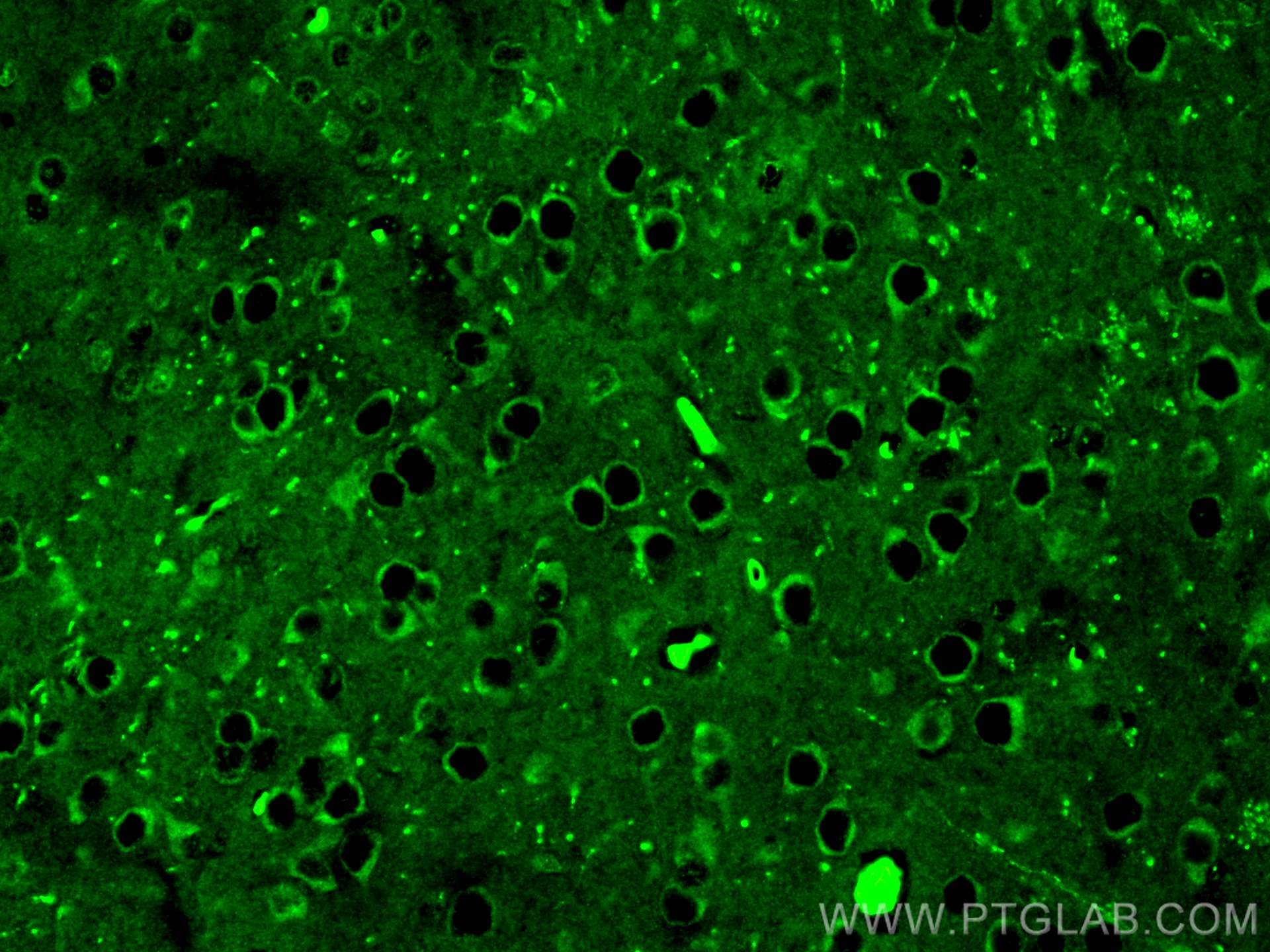 IF Staining of mouse brain using 20877-1-AP
