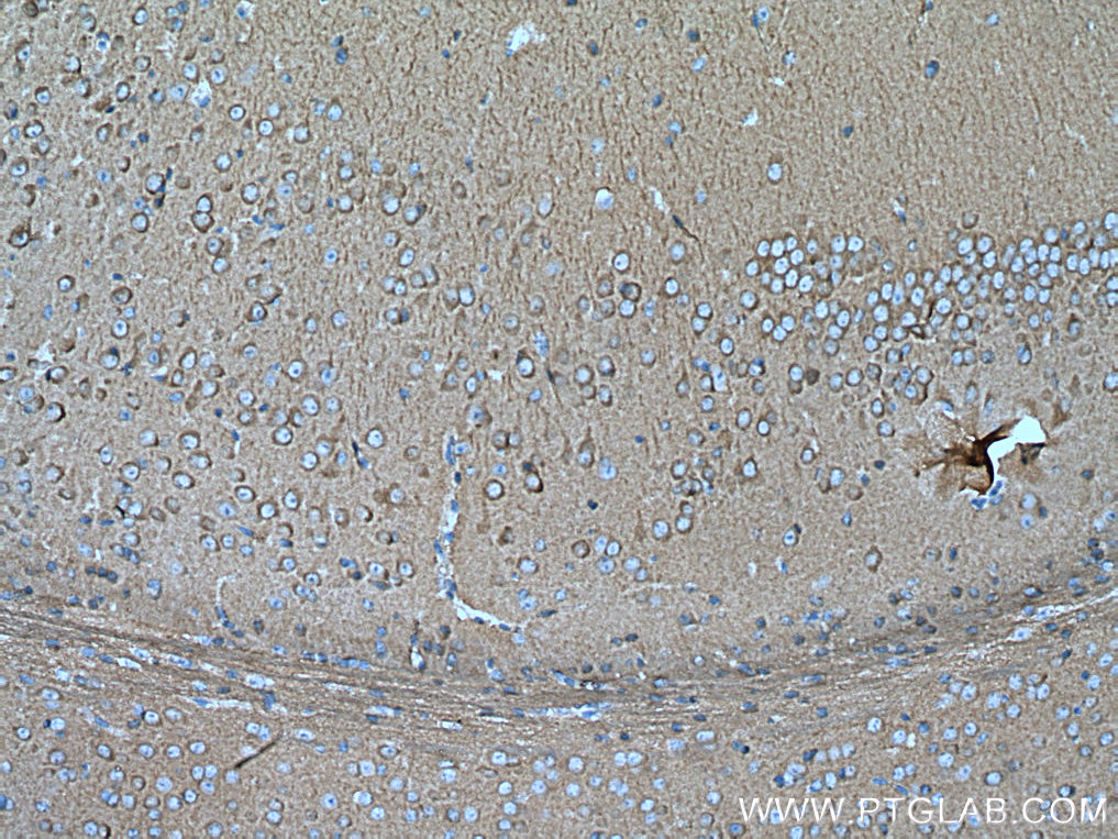 IHC staining of mouse brain using 20877-1-AP