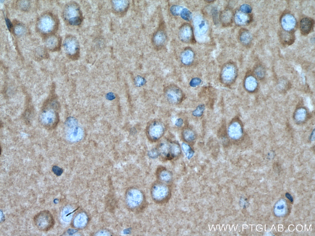 IHC staining of mouse brain using 20877-1-AP