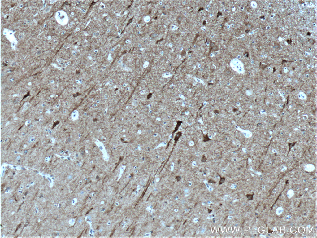IHC staining of human brain using 14364-1-AP