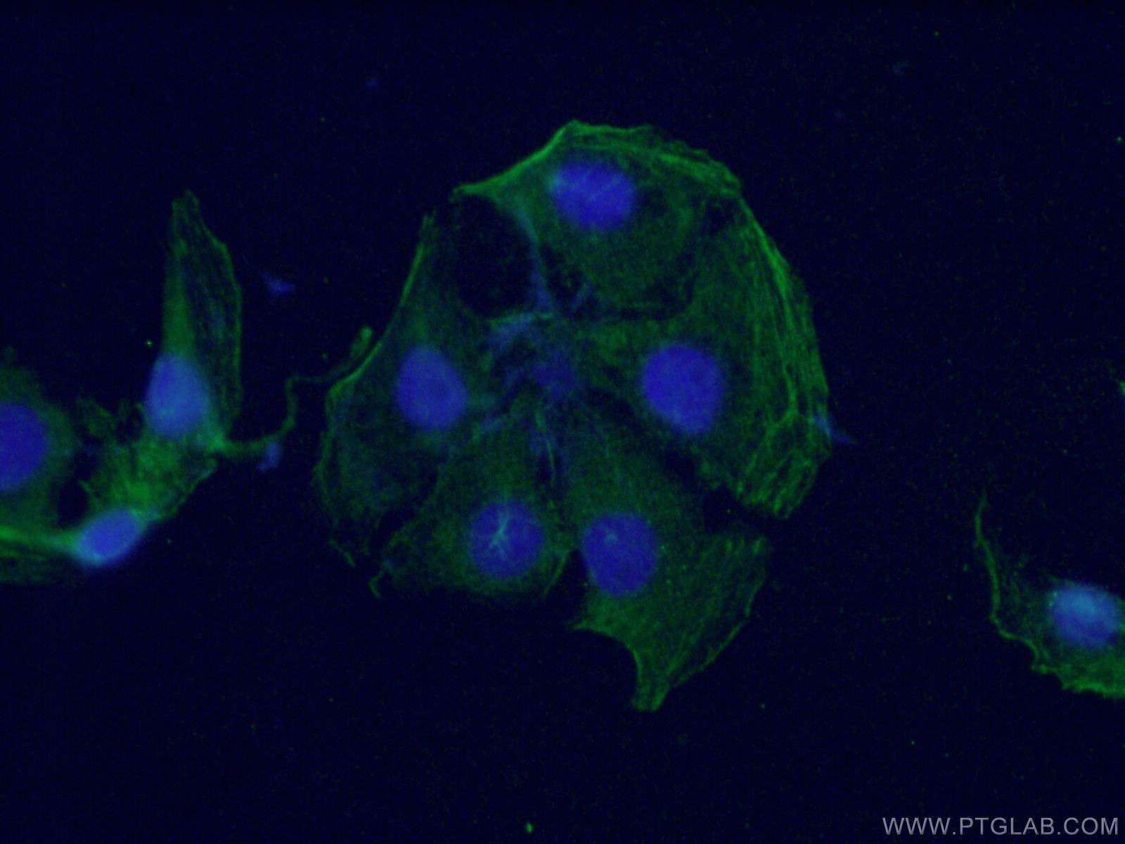 IF Staining of SH-SY5Y using 66429-1-Ig (same clone as 66429-1-PBS)
