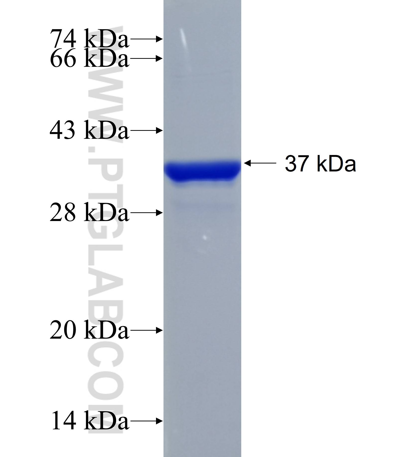PRKCH fusion protein Ag25365 SDS-PAGE PRKCH fusion protein Ag25365 SDS-PAGE