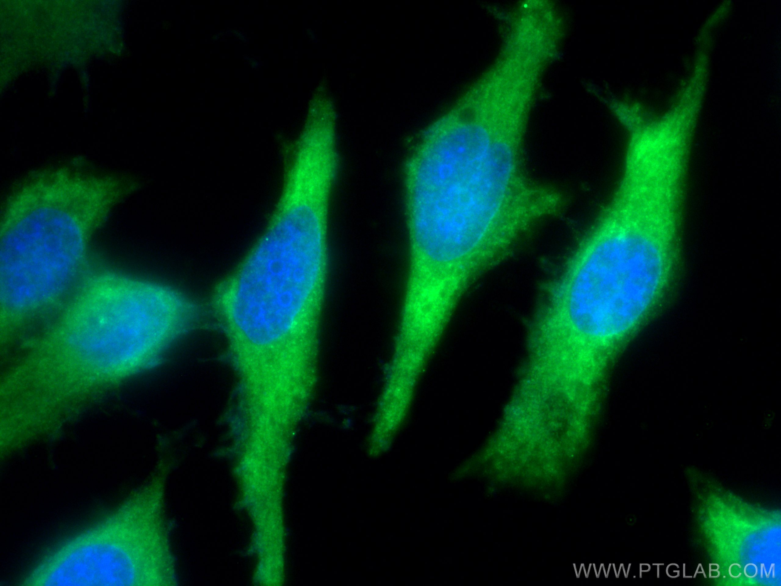 IF Staining of HeLa using 13883-1-AP