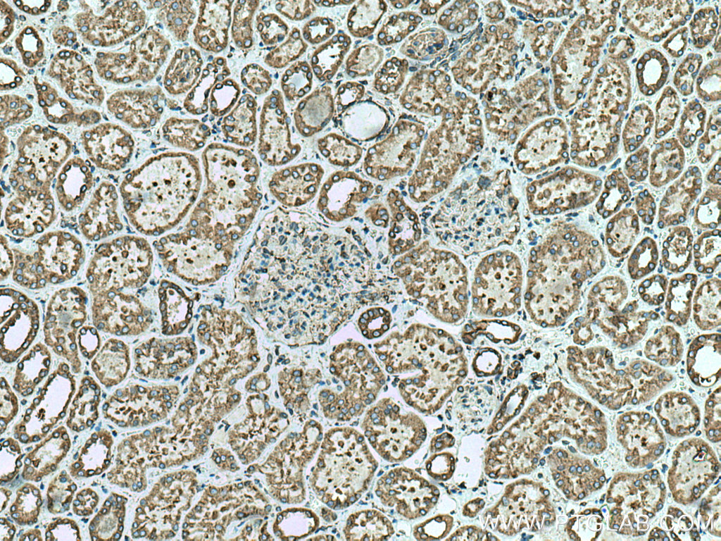 IHC staining of human kidney using 12148-1-AP