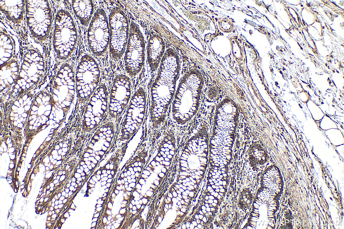 Immunohistochemical analysis of paraffin-embedded human colon tissue slide using 12148-1-AP (PRKCSH antibody) at dilution of 1:1000 (under 10x lens). Heat mediated antigen retrieval with Tris-EDTA buffer (pH 9.0). IHC staining of human colon using 12148-1-AP