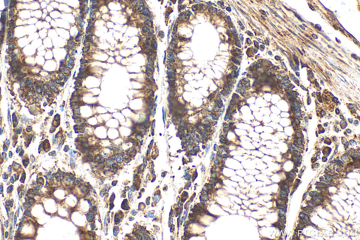 IHC staining of human colon using 12148-1-AP IHC staining of human colon using 12148-1-AP