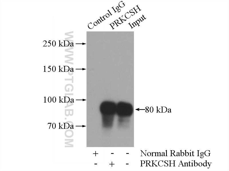 IP experiment of HeLa using 12148-1-AP