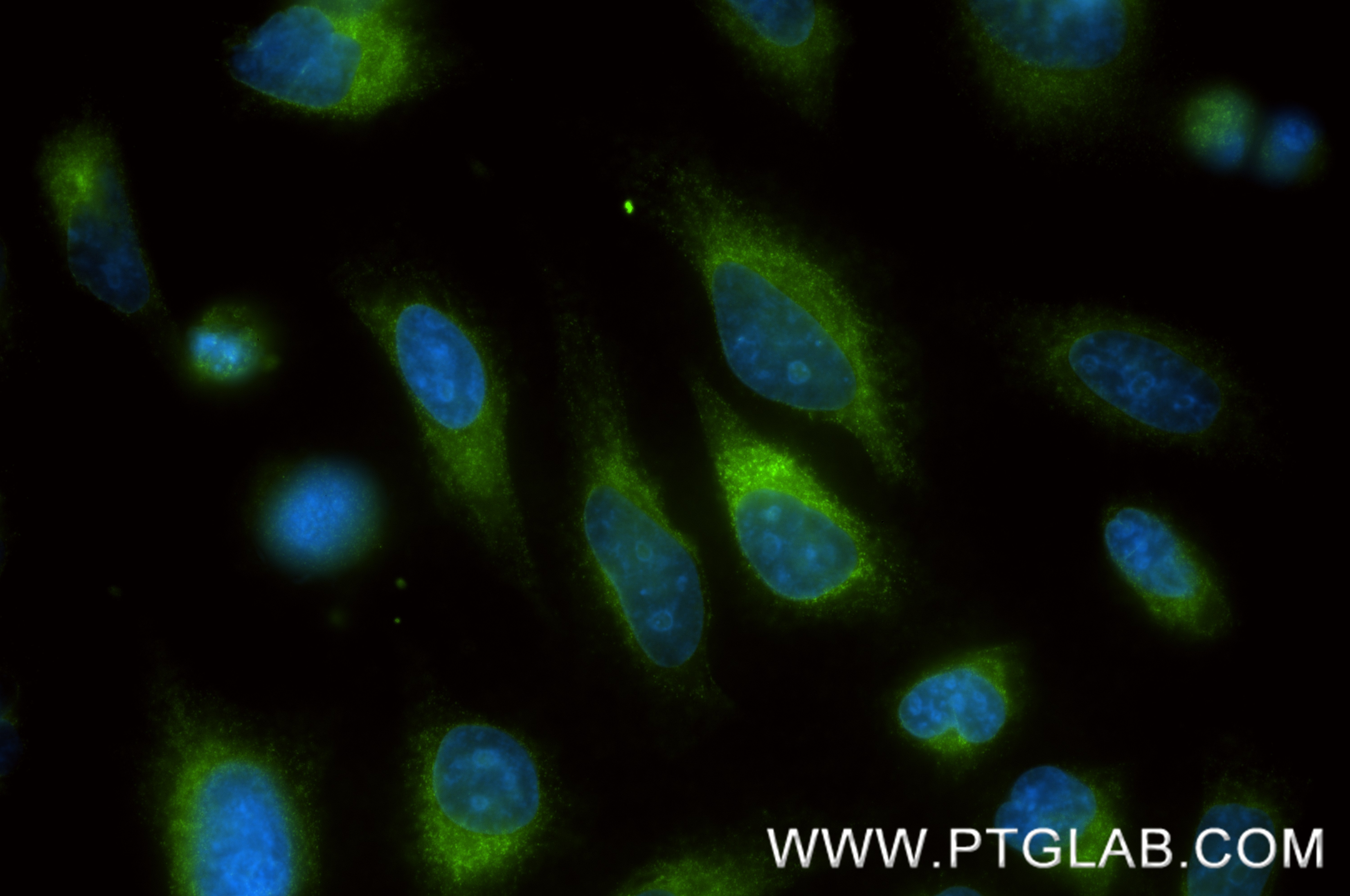 IF Staining of HeLa using 87004-3-RR (same clone as 87004-3-PBS) IF Staining of HeLa using 87004-3-RR (same clone as 87004-3-PBS)