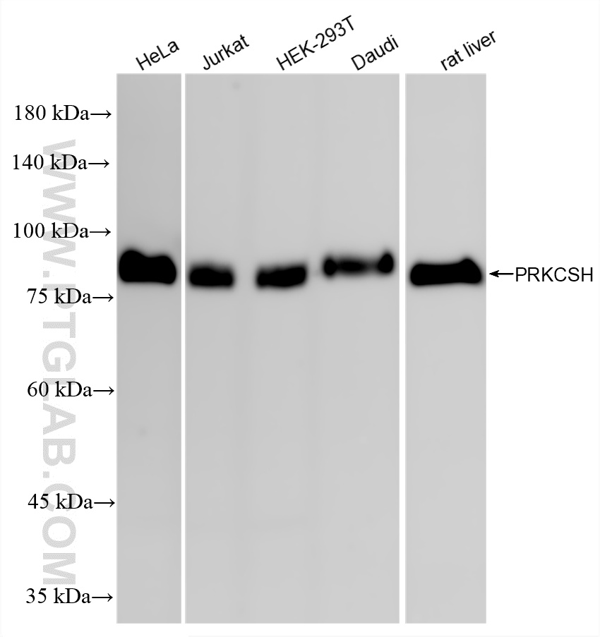 WB analysis using 87004-3-RR (same clone as 87004-3-PBS)