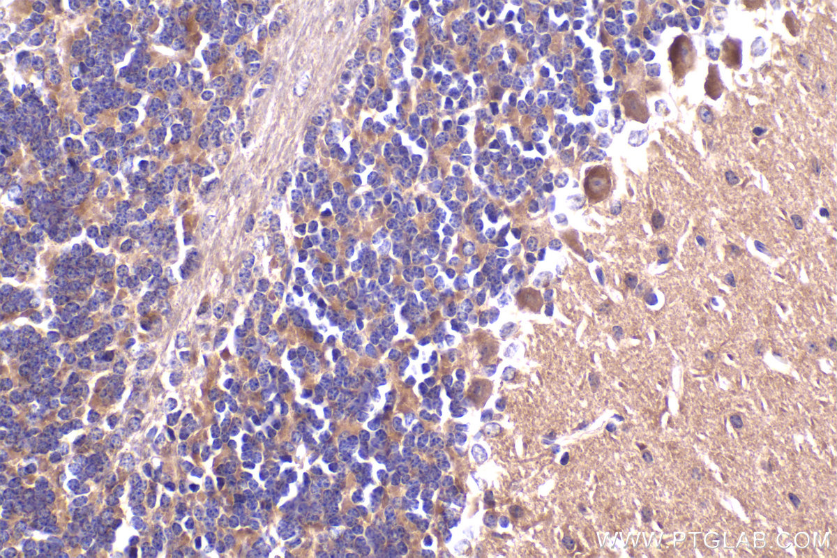 IHC staining of mouse cerebellum using 10860-1-AP